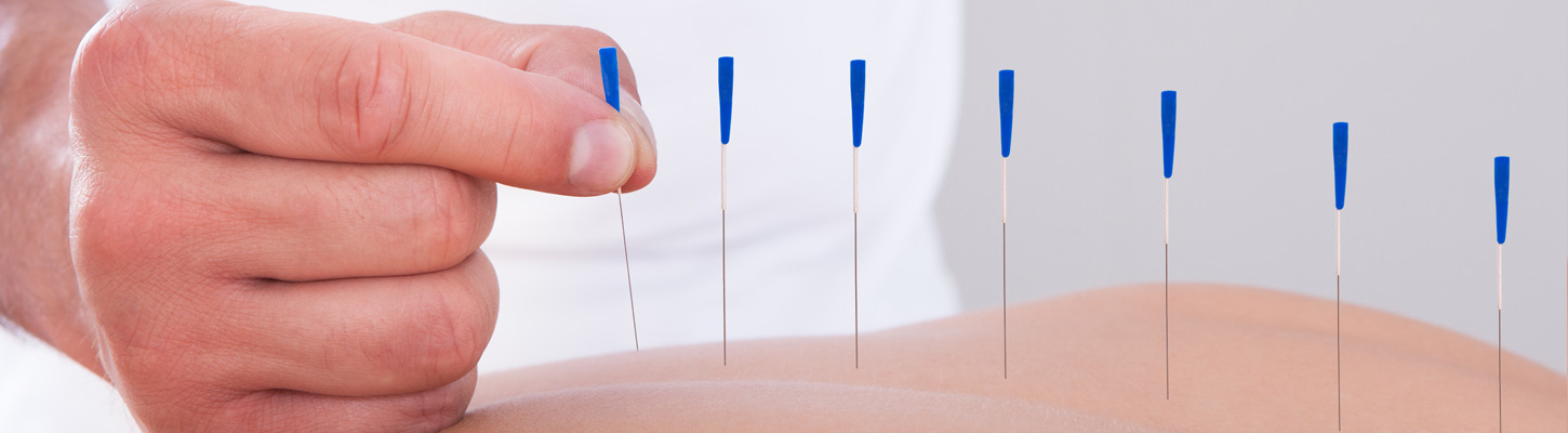 acupuncture-slide2